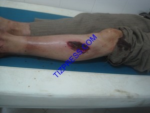 اعتداء_الخنزير_البري_تافراوت_50 (Copier)