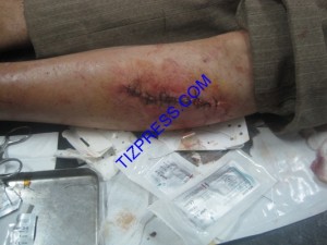 اعتداء_الخنزير_البري_تافراوت_60 (Copier)