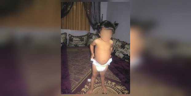 أيت ملول: مأساة طفلة تبكي ليل نهار وتحك جلدها حتى يتقطر دما أيت ملول: مأساة طفلة تبكي ليل نهار وتحك جلدها حتى يتقطر دما