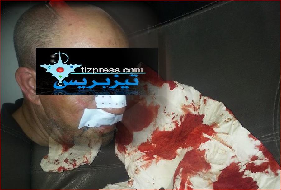 تيزنيت : اعتداء شنيع على موظف سابق بعمالة تيزنيت تيزنيت : اعتداء شنيع على موظف سابق بعمالة تيزنيت
