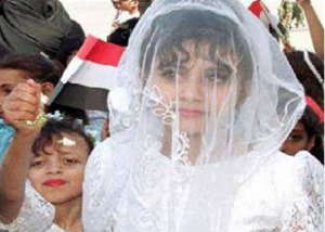 وفاة عروس عمرها 8 سنوات ليلة زفافها باليمن - البيان