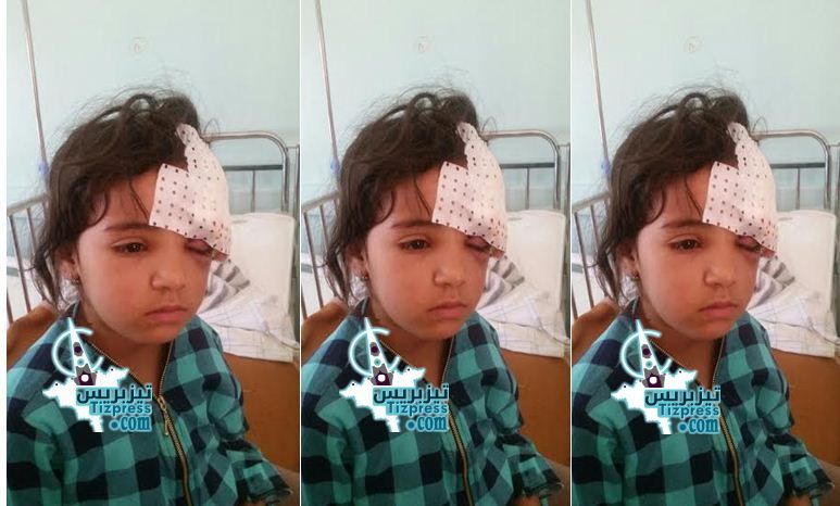 أنزي : نهاية مأساوية للطفلة «مَــــلاَك » إثر عضة كلب ..وأسرتها بعد هلاكها تقرر مقاضاة المسؤولين بتهمة الإهمال الطبي أنزي : نهاية مأساوية للطفلة «مَــــلاَك » إثر عضة كلب ..وأسرتها بعد هلاكها تقرر مقاضاة المسؤولين بتهمة الإهمال الطبي