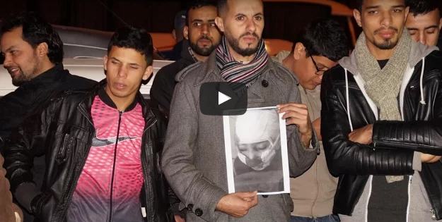 غياب لقاح داء السعار بمستشفى تيزنيت  يُخرج عشرات المواطنيين للإحتجاج