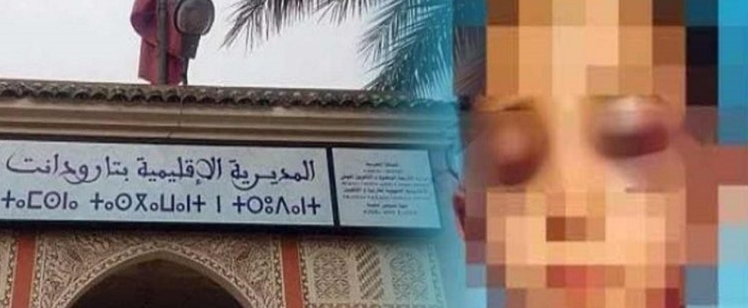 إحالة أستاذ تارودانت على السجن الفلاحي ومتابعته في حالة اعتقال إحالة أستاذ تارودانت على السجن الفلاحي ومتابعته في حالة اعتقال