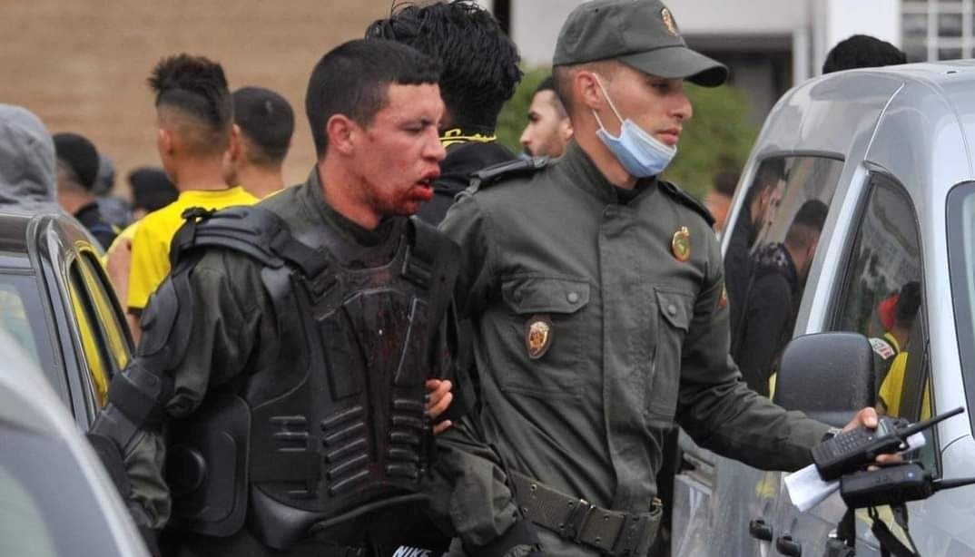 إصابة 103 عنصرا أمنيا وتوقيف 160 شخصا بينهم 90 قاصرا في شغب مباراة الجيش والمغرب الفاسي إصابة 103 عنصرا أمنيا وتوقيف 160 شخصا بينهم 90 قاصرا في شغب مباراة الجيش والمغرب الفاسي