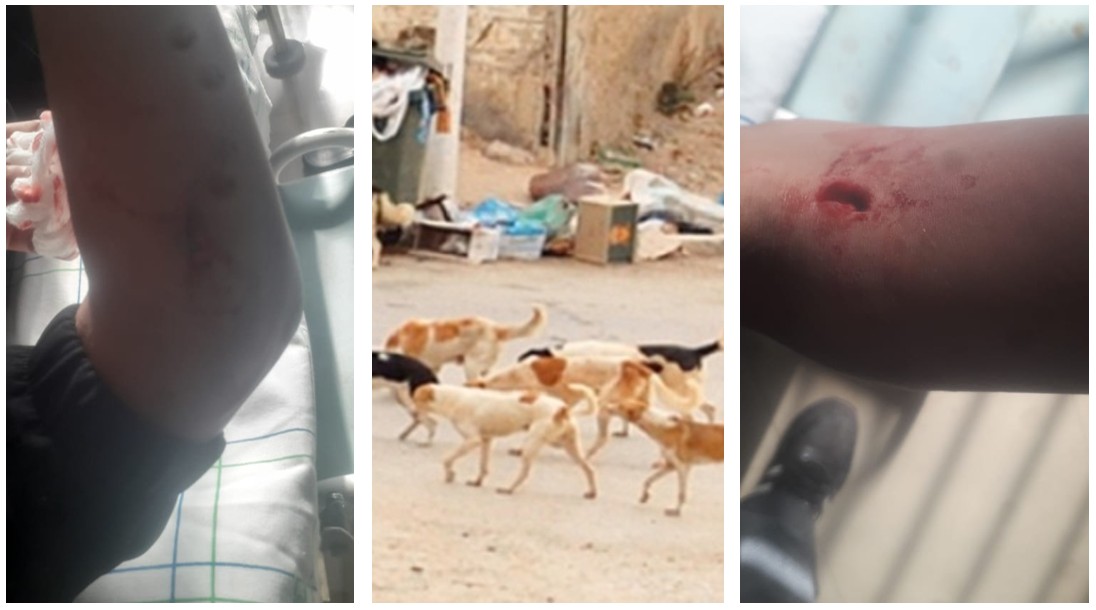 تيزنيت : ياسمين ومحمد.. حين تتحول طريق المدرسة إلى “كمين” لأنياب الكلاب الضالة.